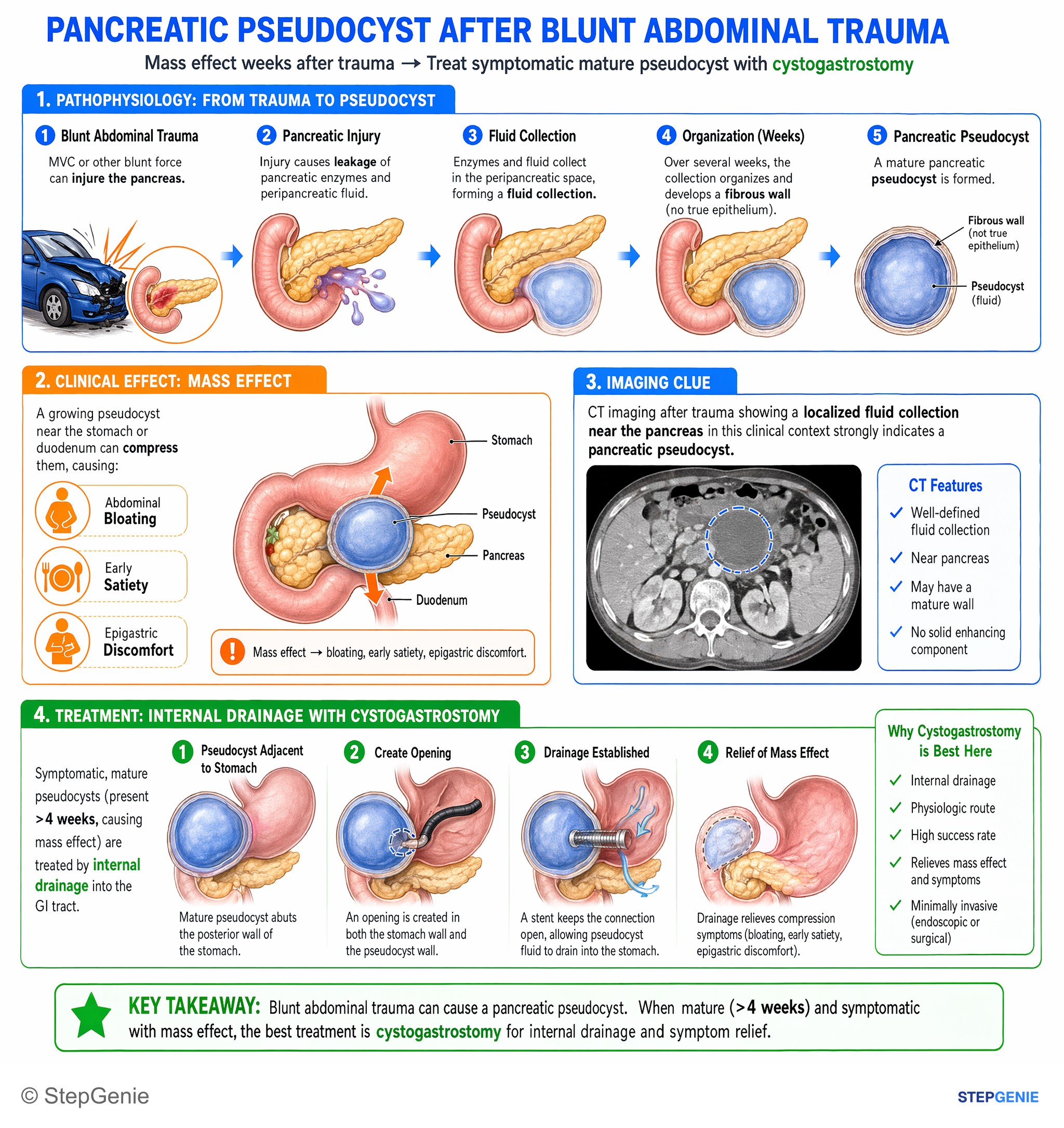 Pancreatic disorders — StepGenie USMLE Step 2 explanation infographic