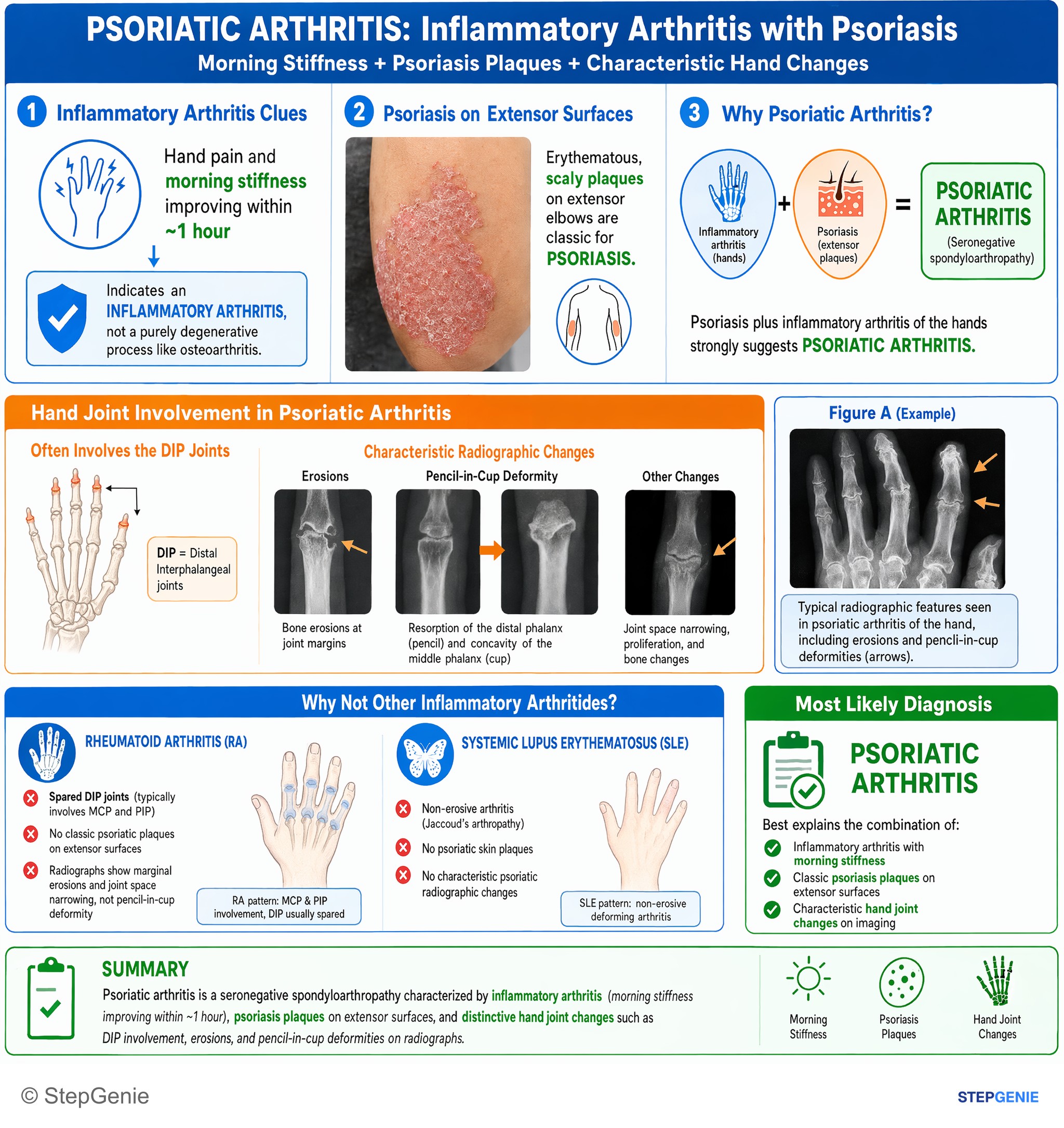 Arthritis and spondyloarthropathies — StepGenie USMLE Step 2 explanation infographic