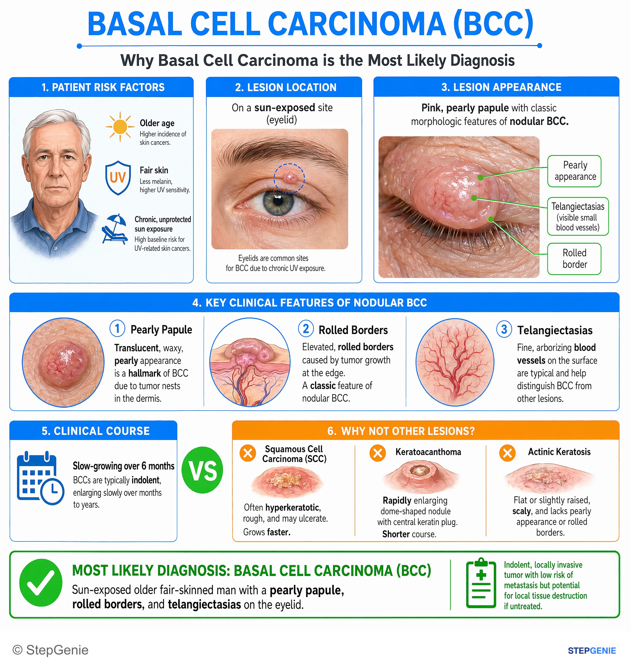 Skin tumors and tumor-like lesions — StepGenie USMLE Step 2 explanation infographic