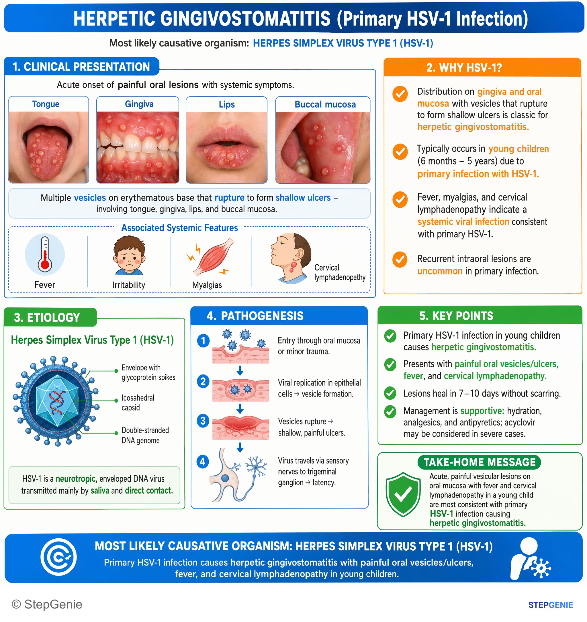 Viral infections — StepGenie USMLE Step 1 explanation infographic