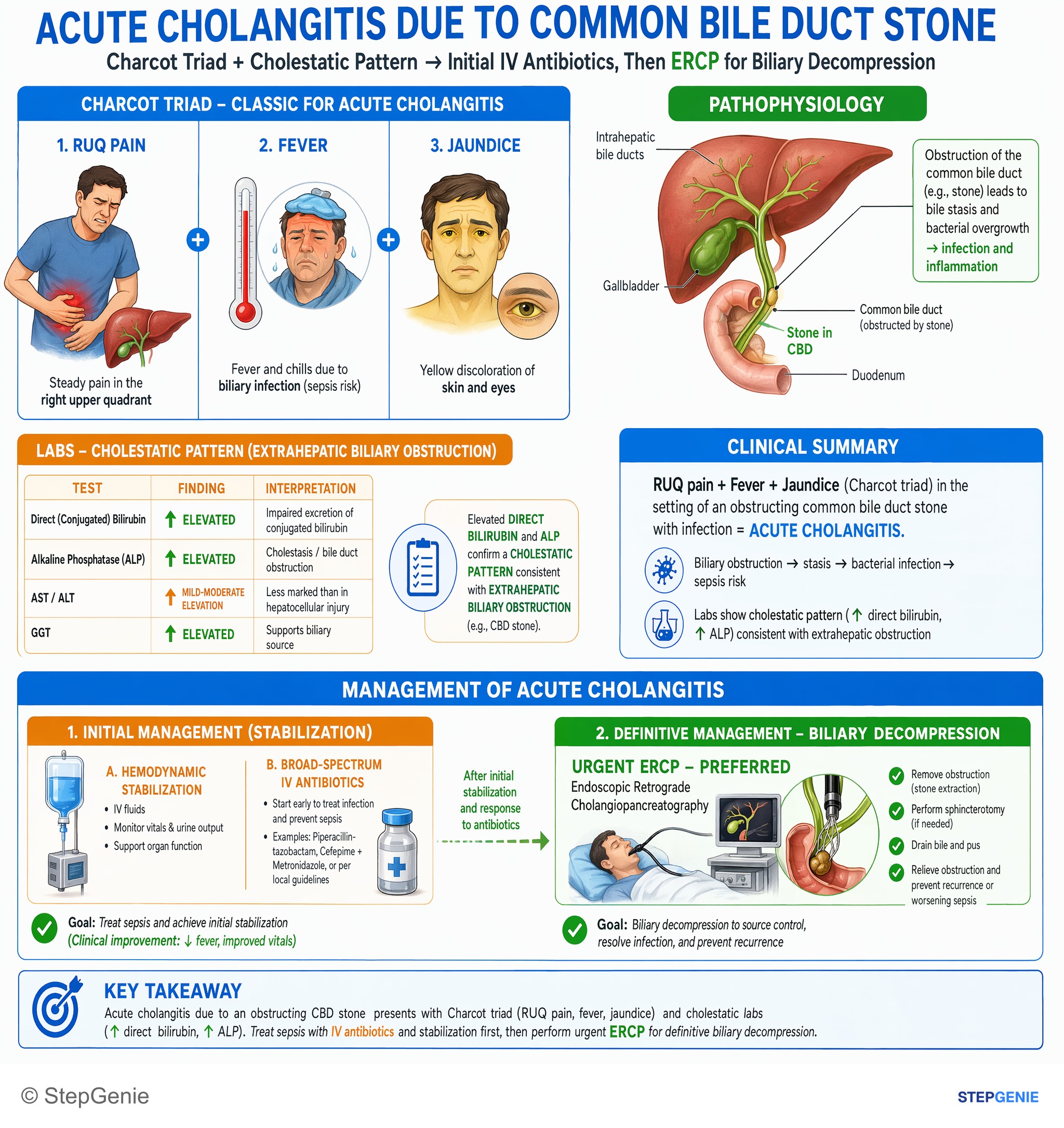 Biliary tract disorders — StepGenie USMLE Step 2 explanation infographic