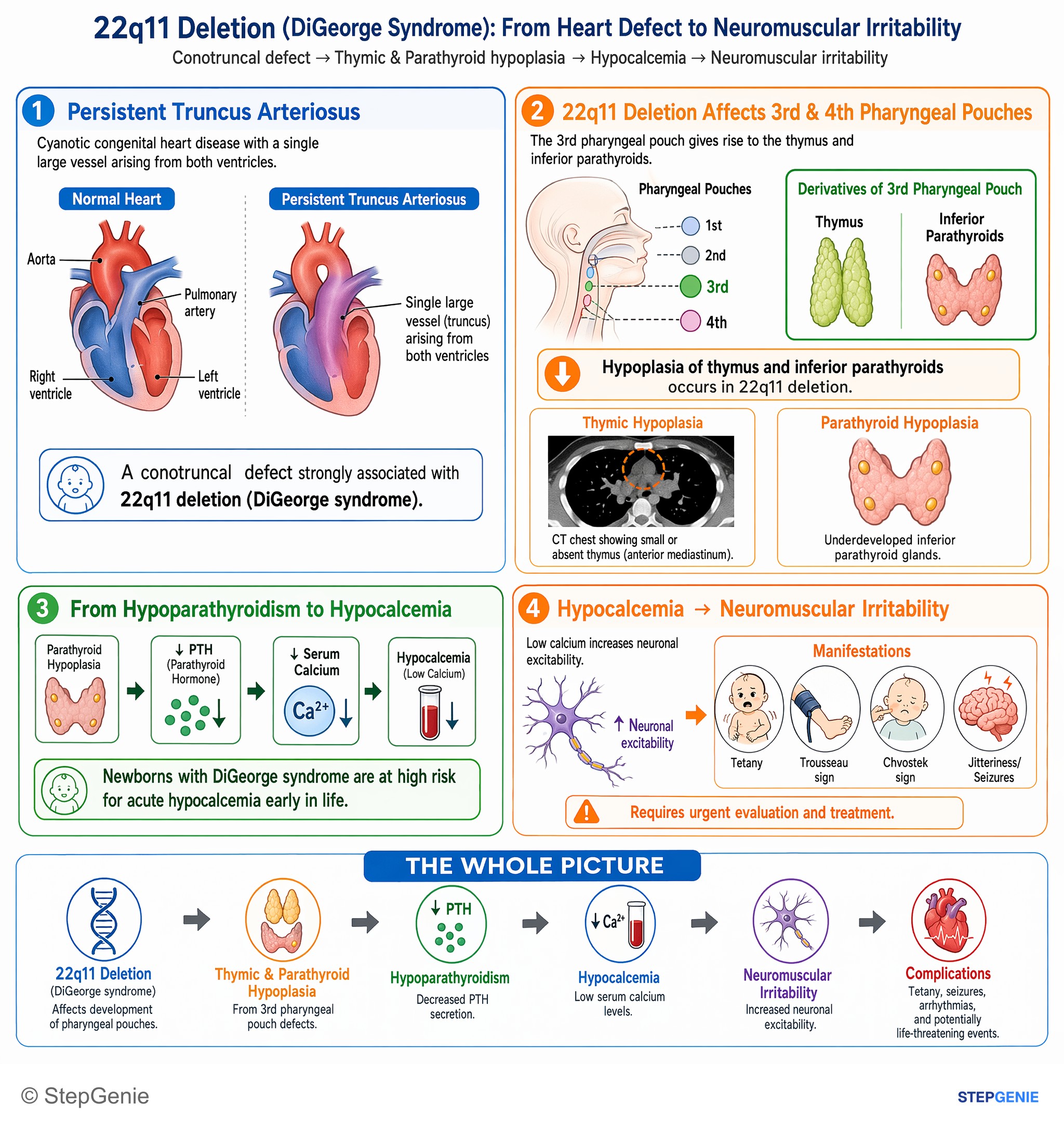 Immunodeficiency syndromes — StepGenie USMLE Step 1 explanation infographic