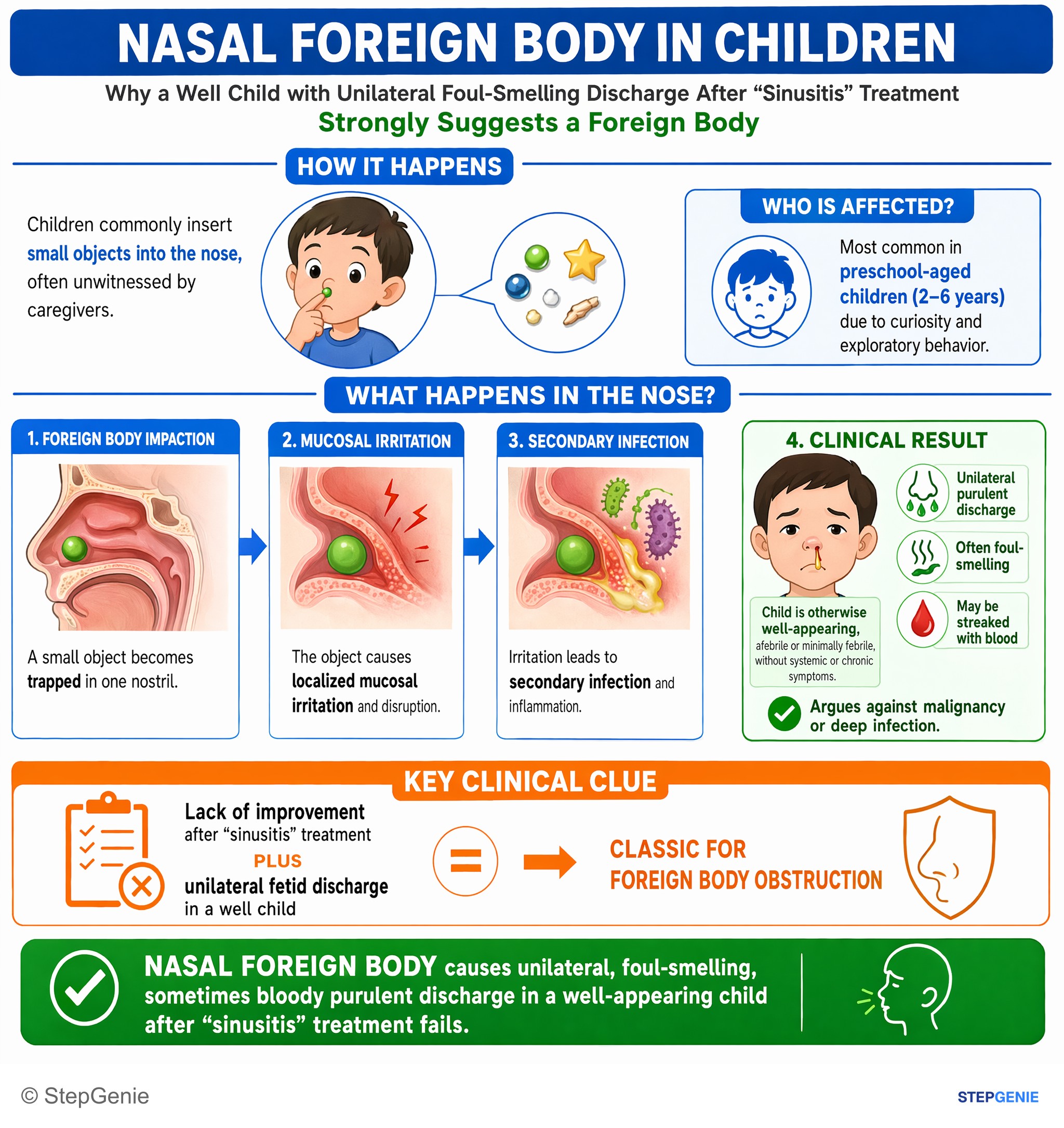 Step-by-step reasoning infographic: Nasal foreign body causes unilateral, foul-smelling, sometimes bloody purulent discharge in a well-appearing child after “sinusitis” treatment fails.