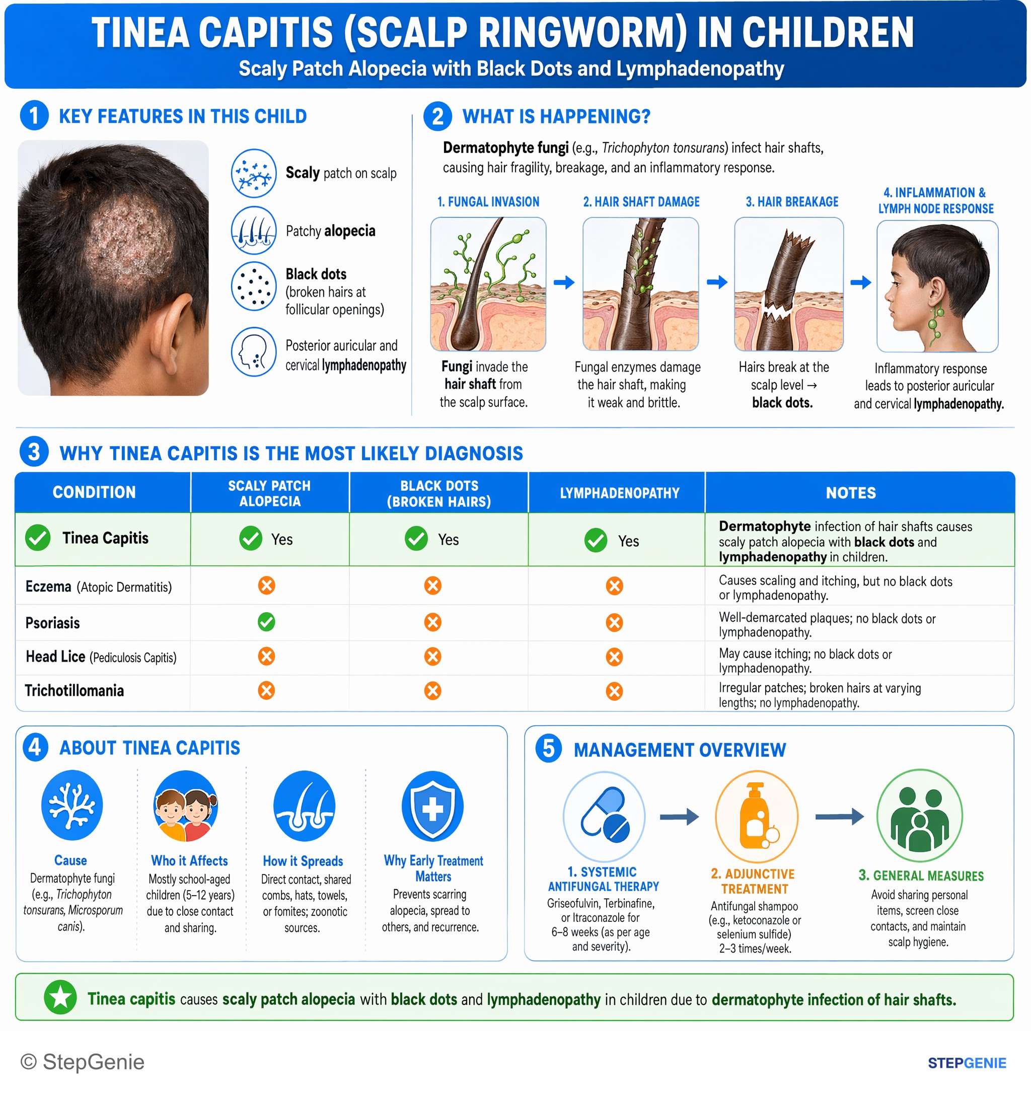 Fungal infections — StepGenie USMLE Step 2 explanation infographic
