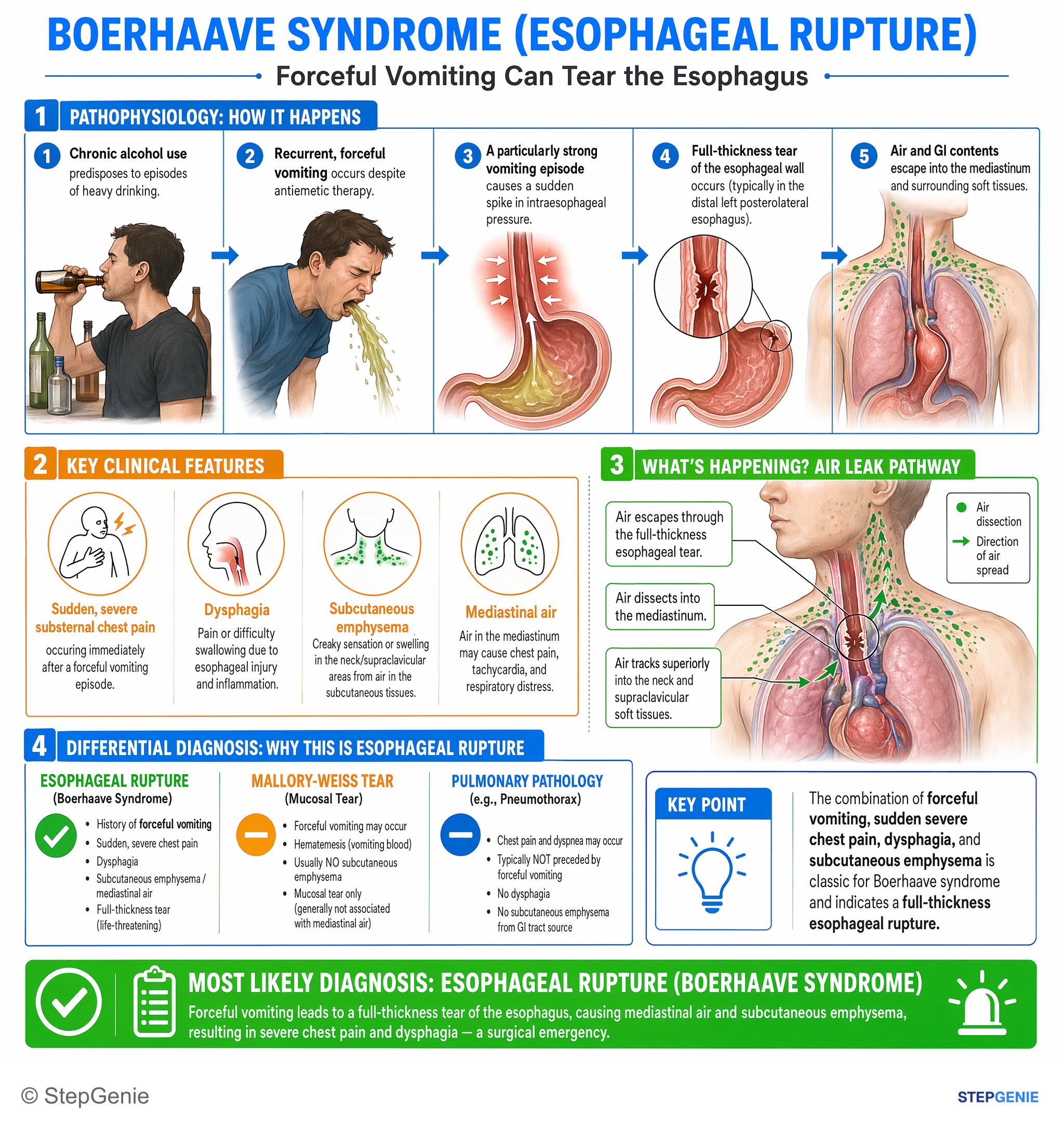 Step-by-step reasoning infographic: Boerhaave syndrome (esophageal rupture) from forceful vomiting → severe chest pain + dysphagia + subcutaneous emphysema/mediastinal air.