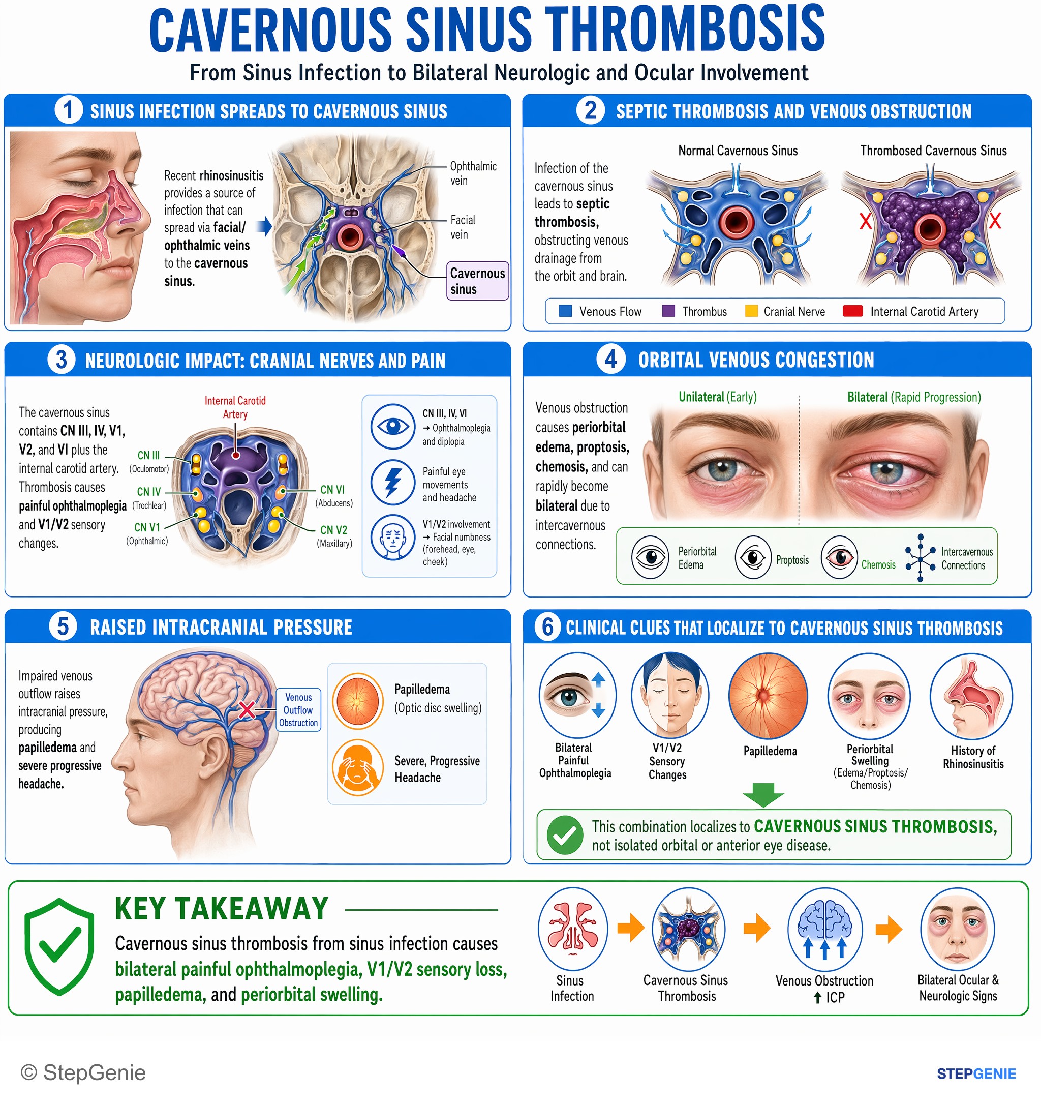 CNS infections — StepGenie USMLE Step 2 explanation infographic