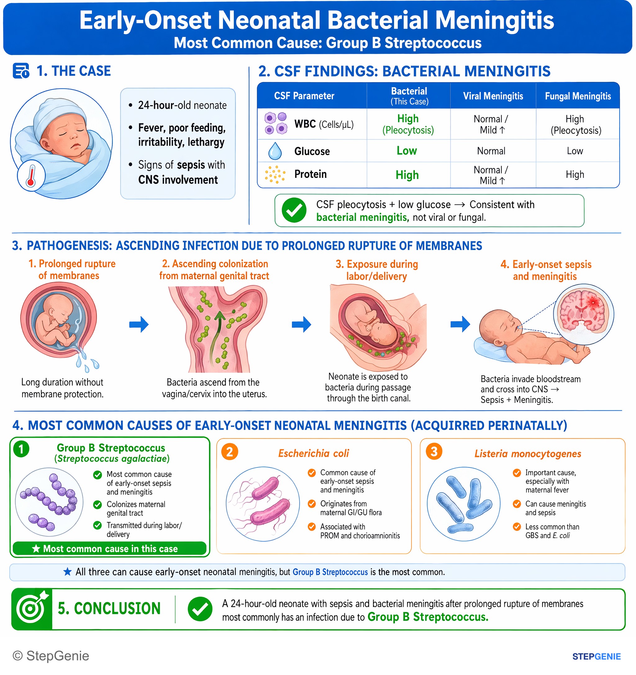 Bacterial infections — StepGenie USMLE Step 1 explanation infographic