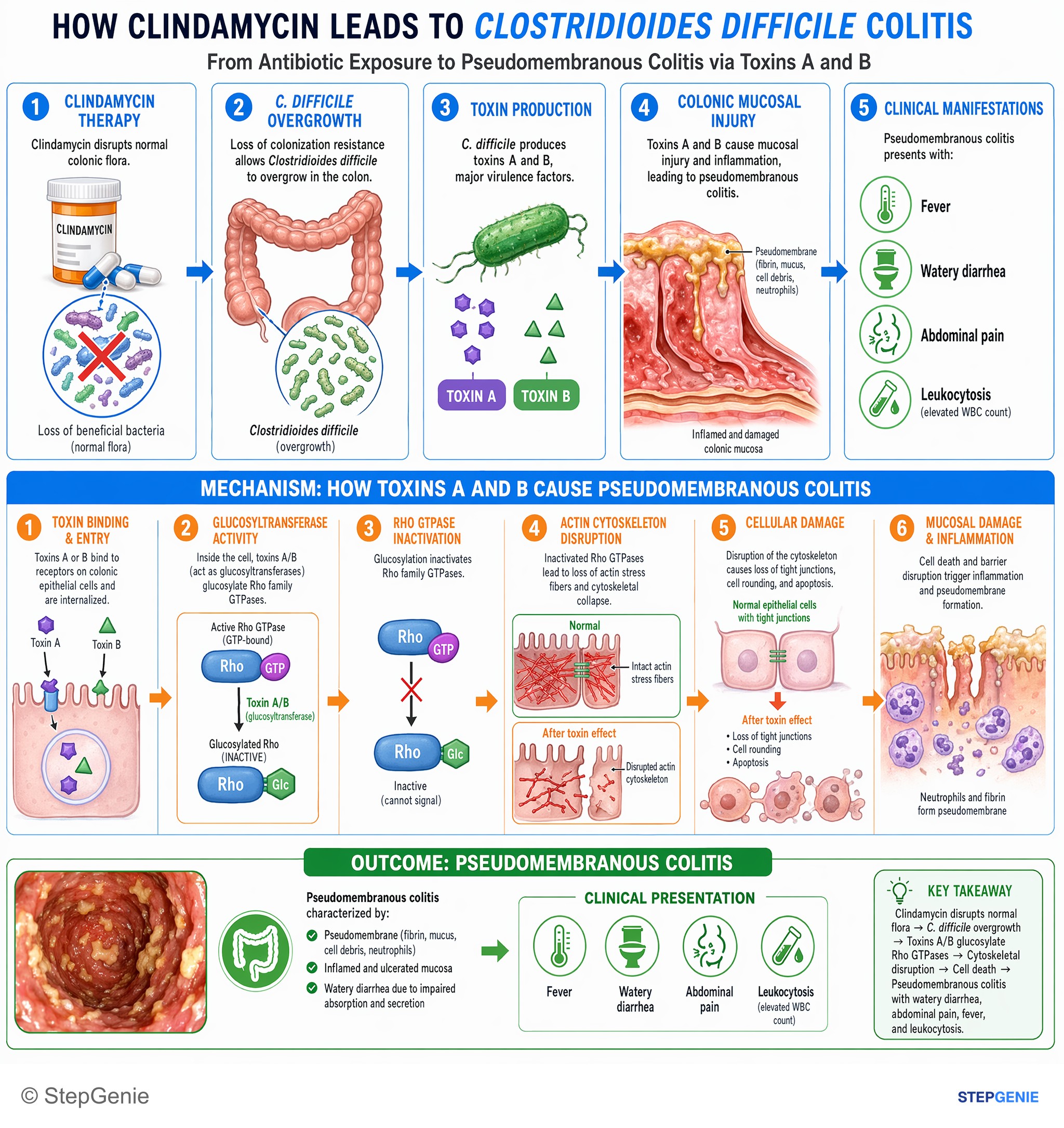 Gastroenterology — StepGenie USMLE Step 1 explanation infographic