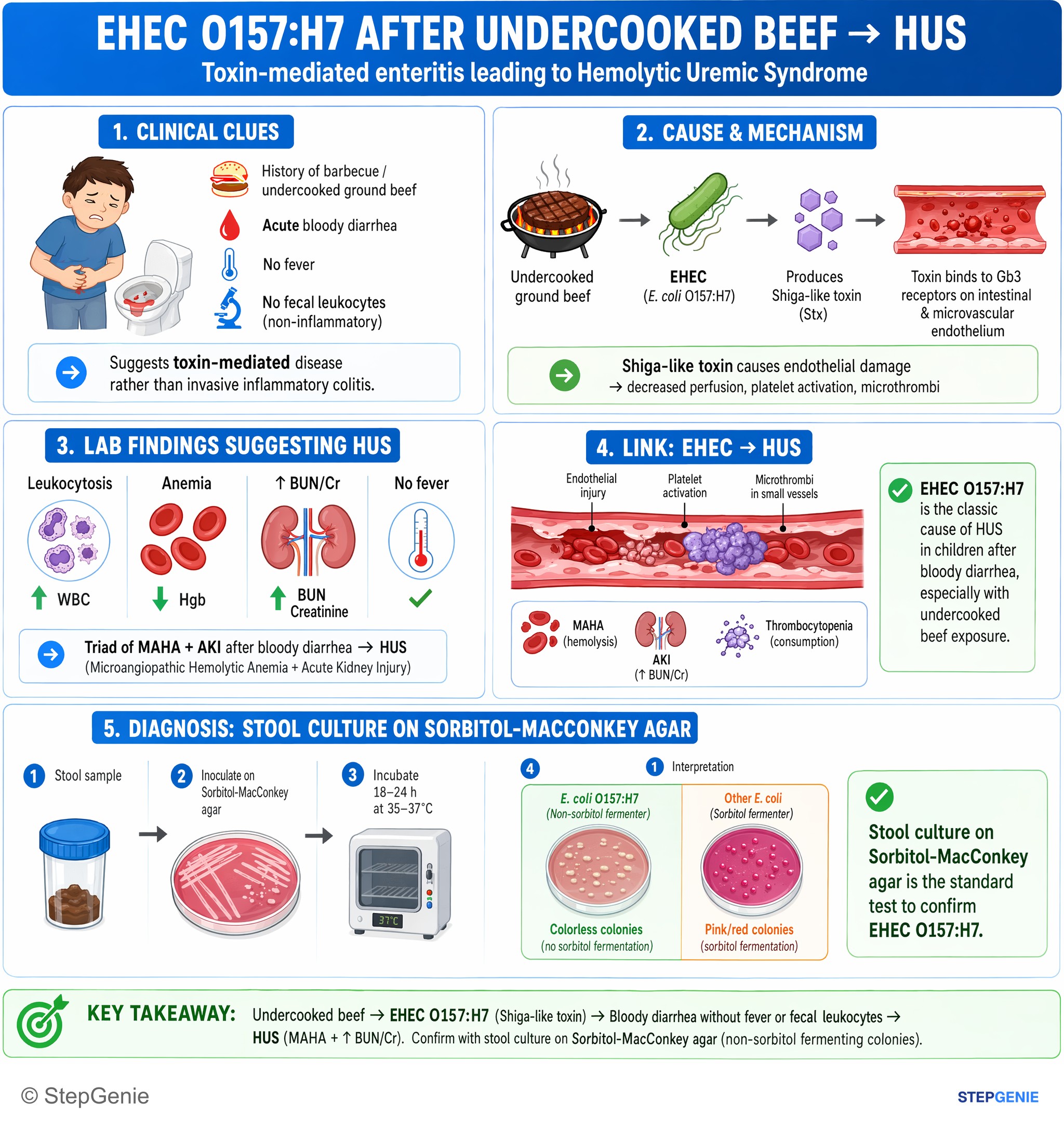 Bacterial infections — StepGenie USMLE Step 1 explanation infographic