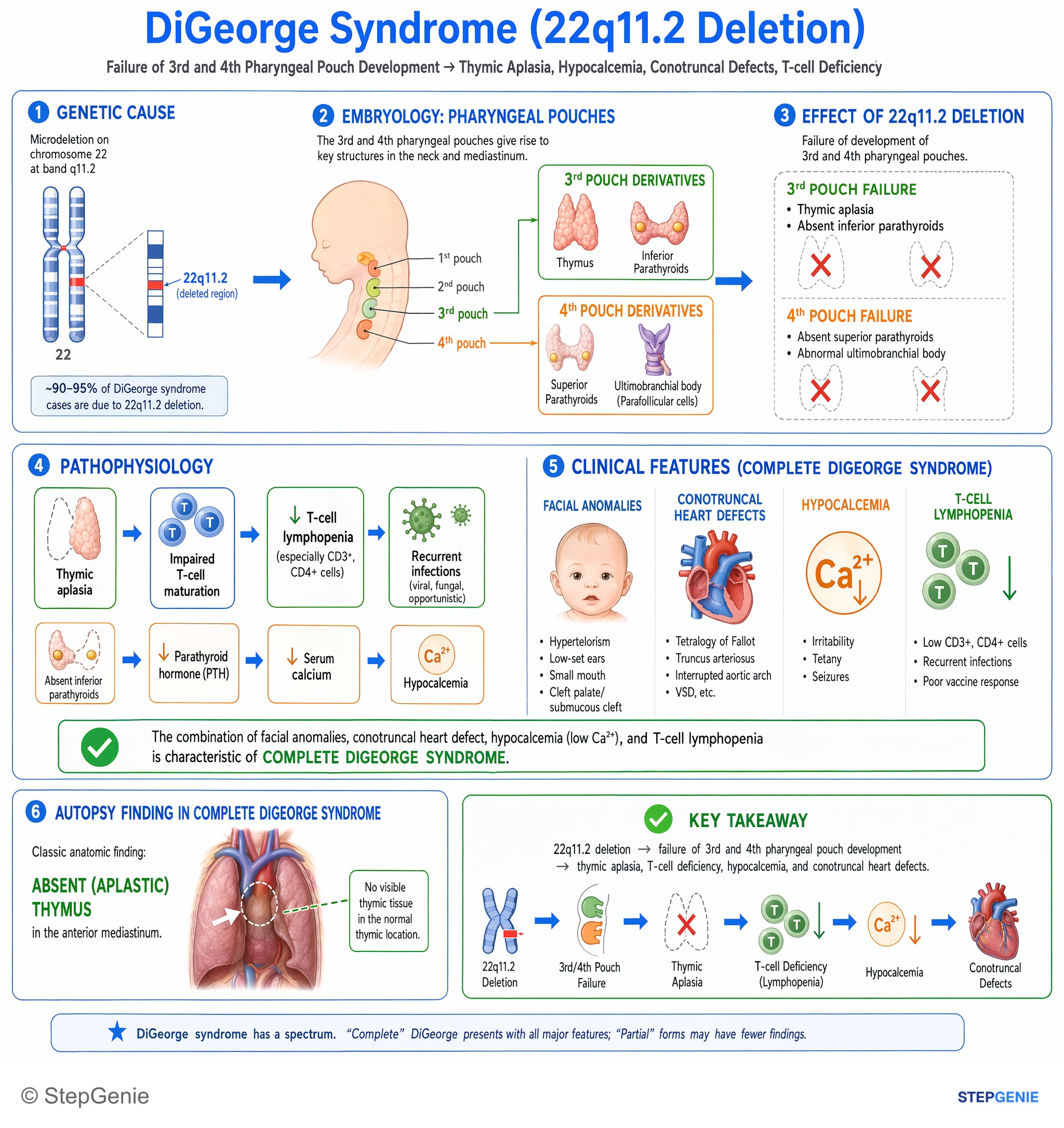 Immunodeficiency syndromes — StepGenie USMLE Step 1 explanation infographic
