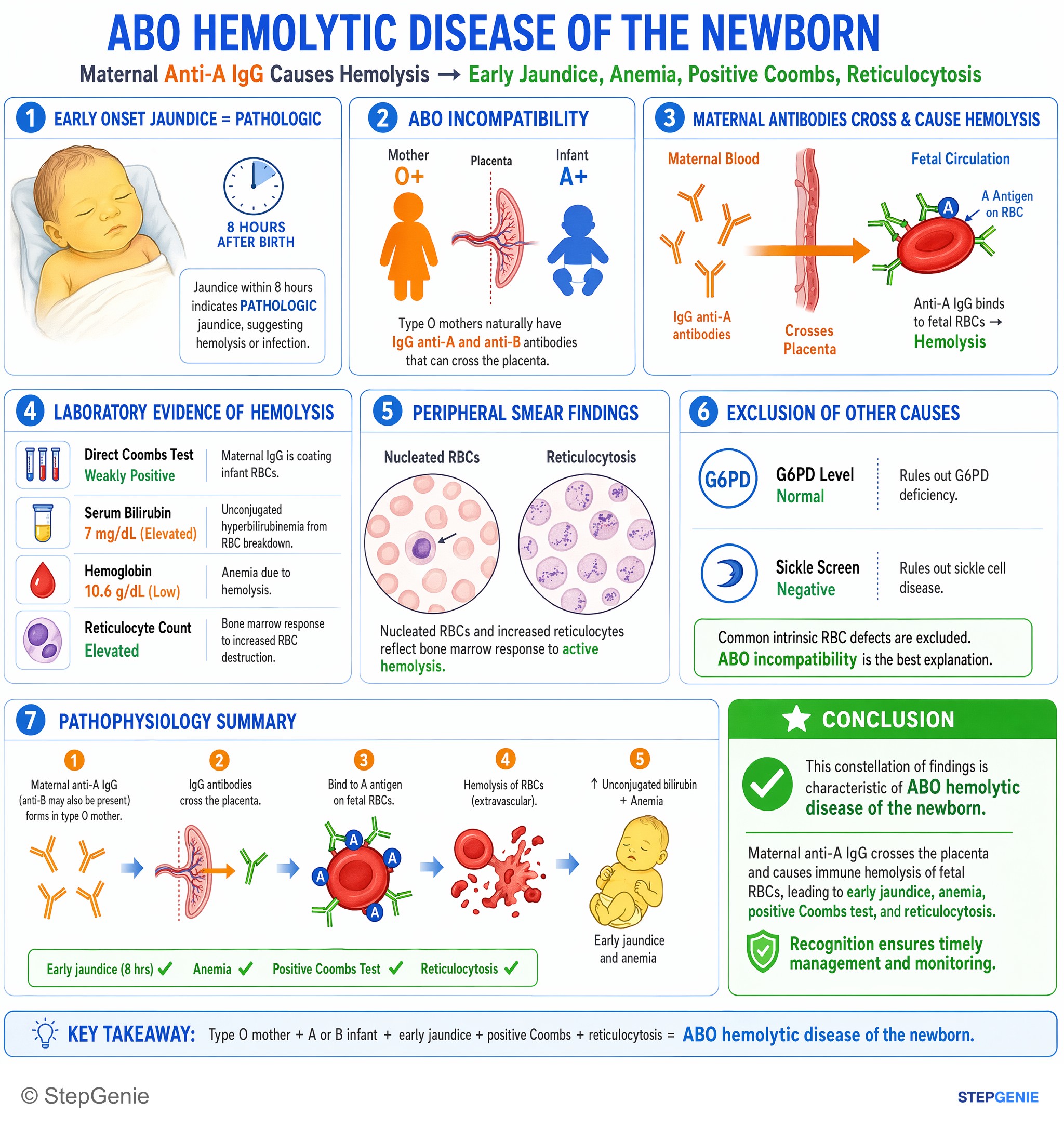 Step-by-step reasoning infographic: ABO hemolytic disease of the newborn: maternal anti-A IgG crosses placenta → hemolysis, early jaundice, anemia, positive Coombs, reticulocytosis.