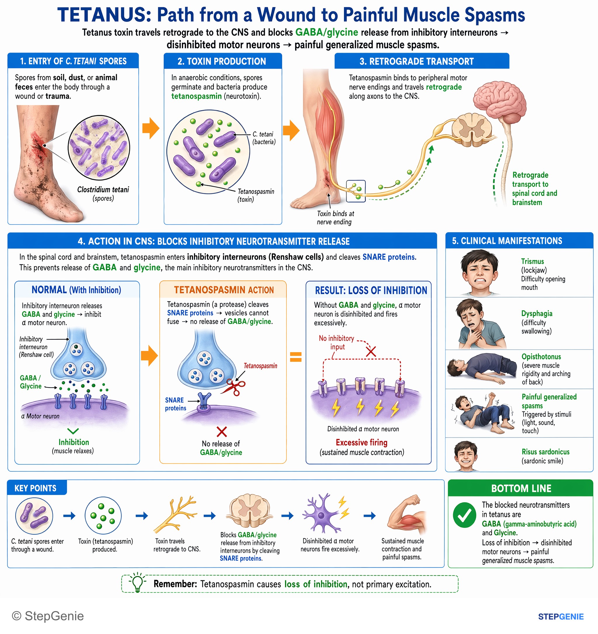 CNS infections — StepGenie USMLE Step 1 explanation infographic