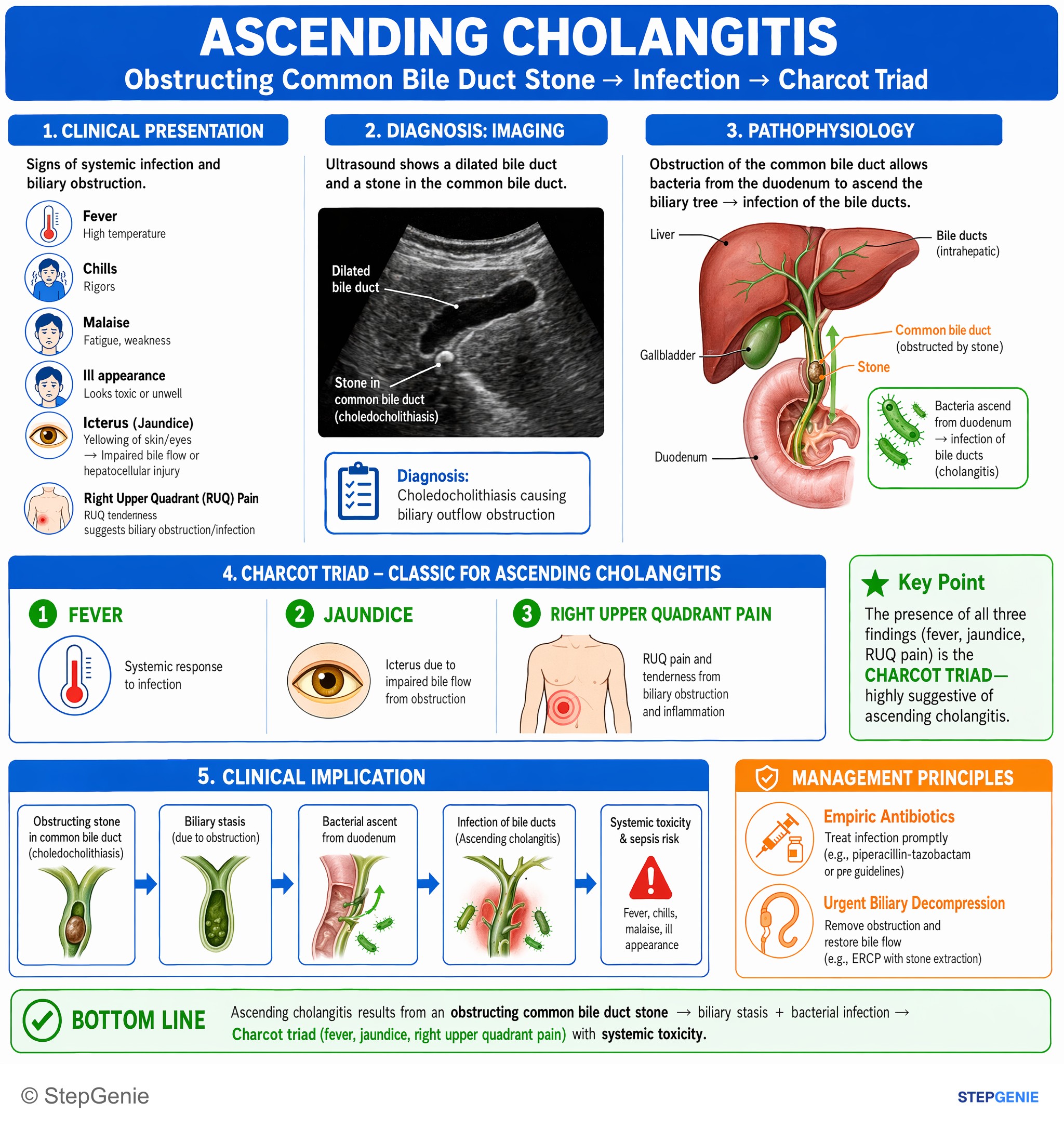 Biliary tract disorders — StepGenie USMLE Step 1 explanation infographic