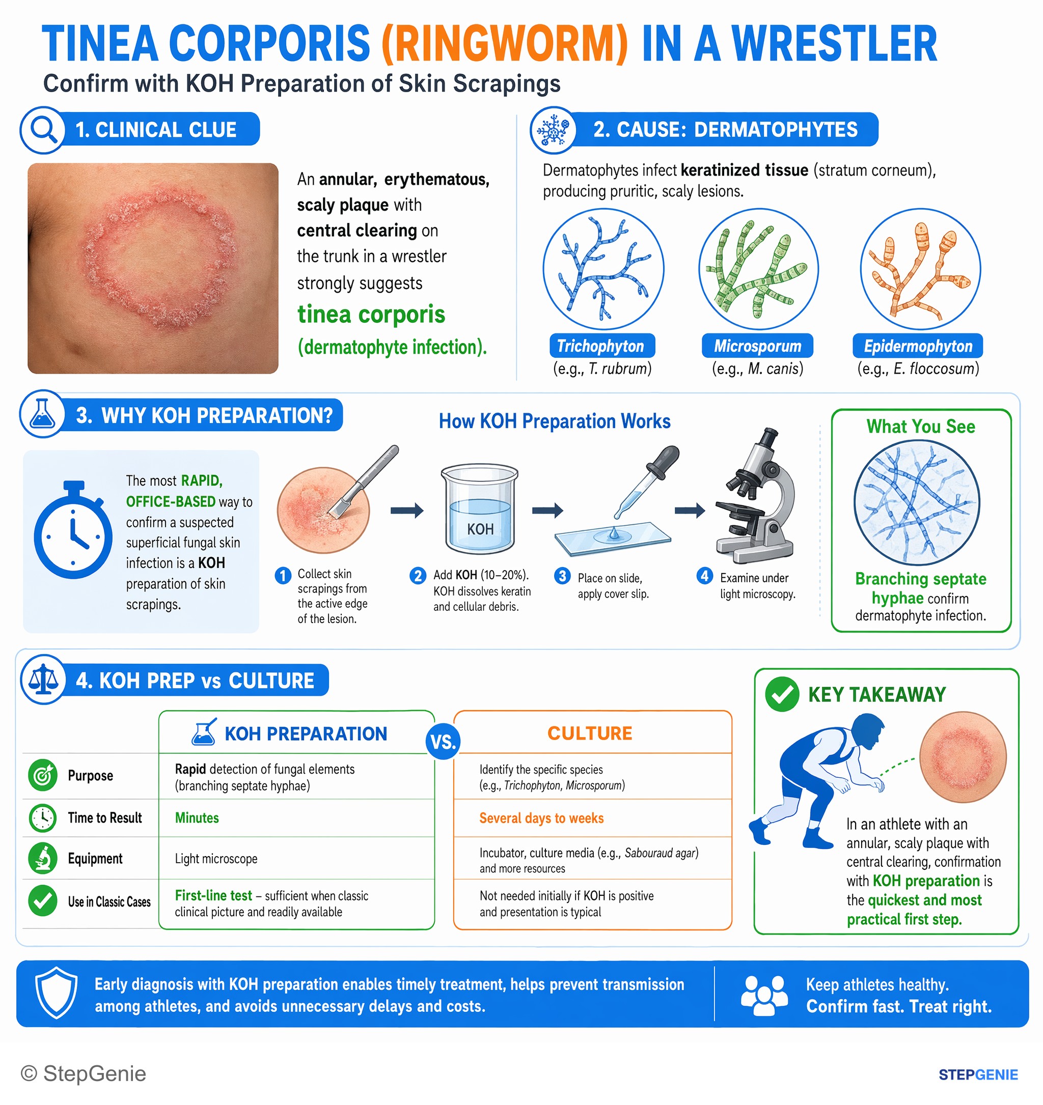 Skin and soft tissue infections — StepGenie USMLE Step 2 explanation infographic