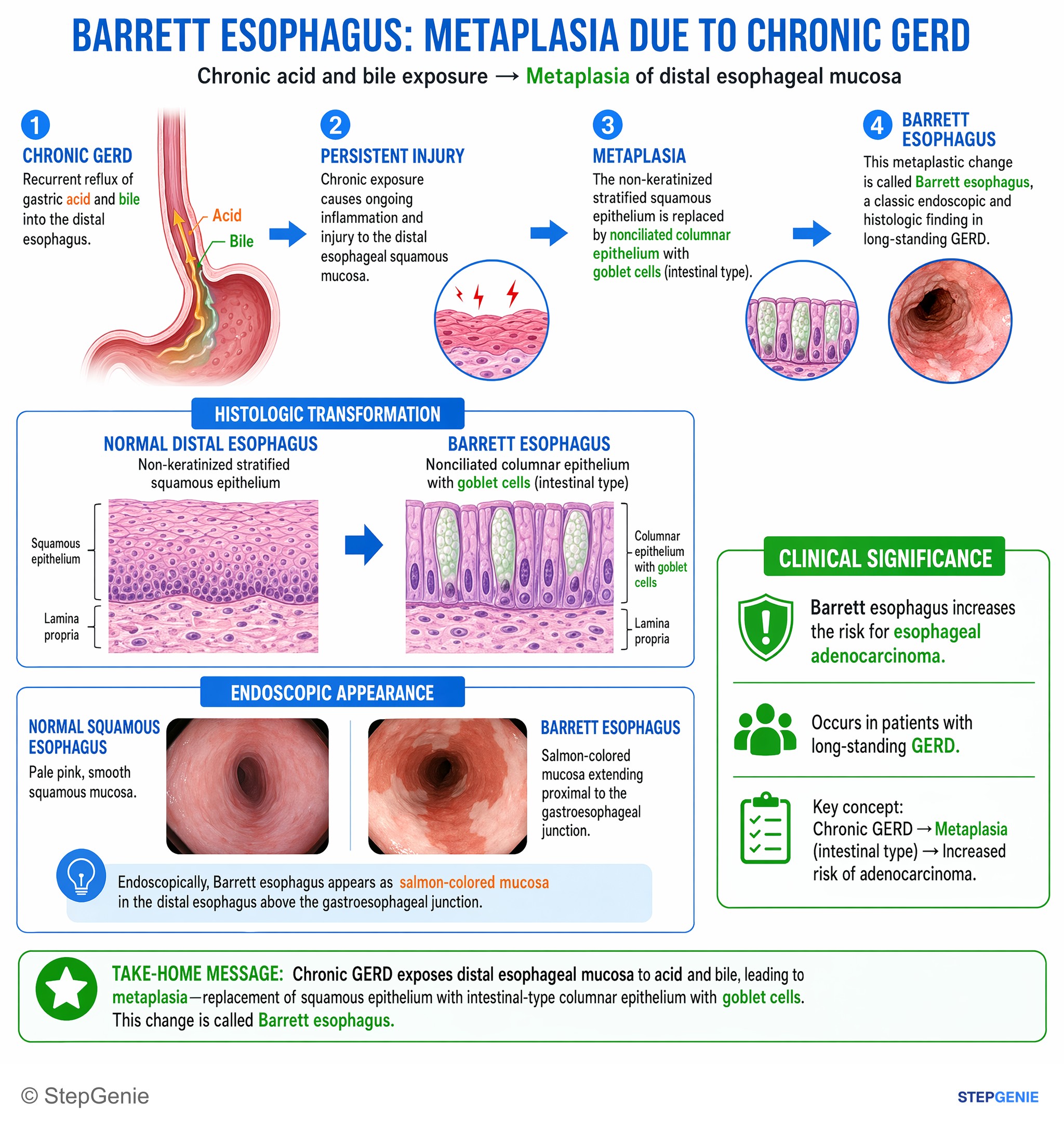 Gastroesophageal disorders — StepGenie USMLE Step 1 explanation infographic