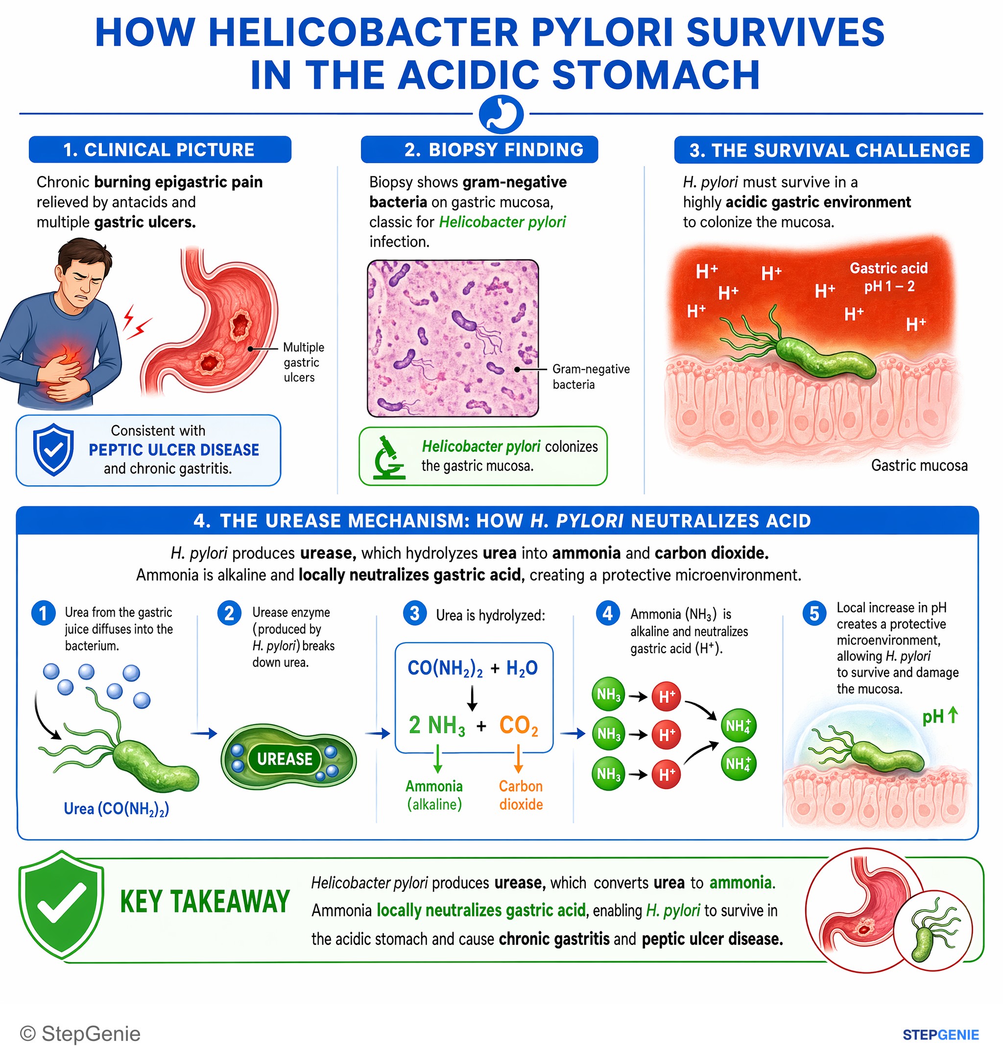 Gastroesophageal disorders — StepGenie USMLE Step 1 explanation infographic