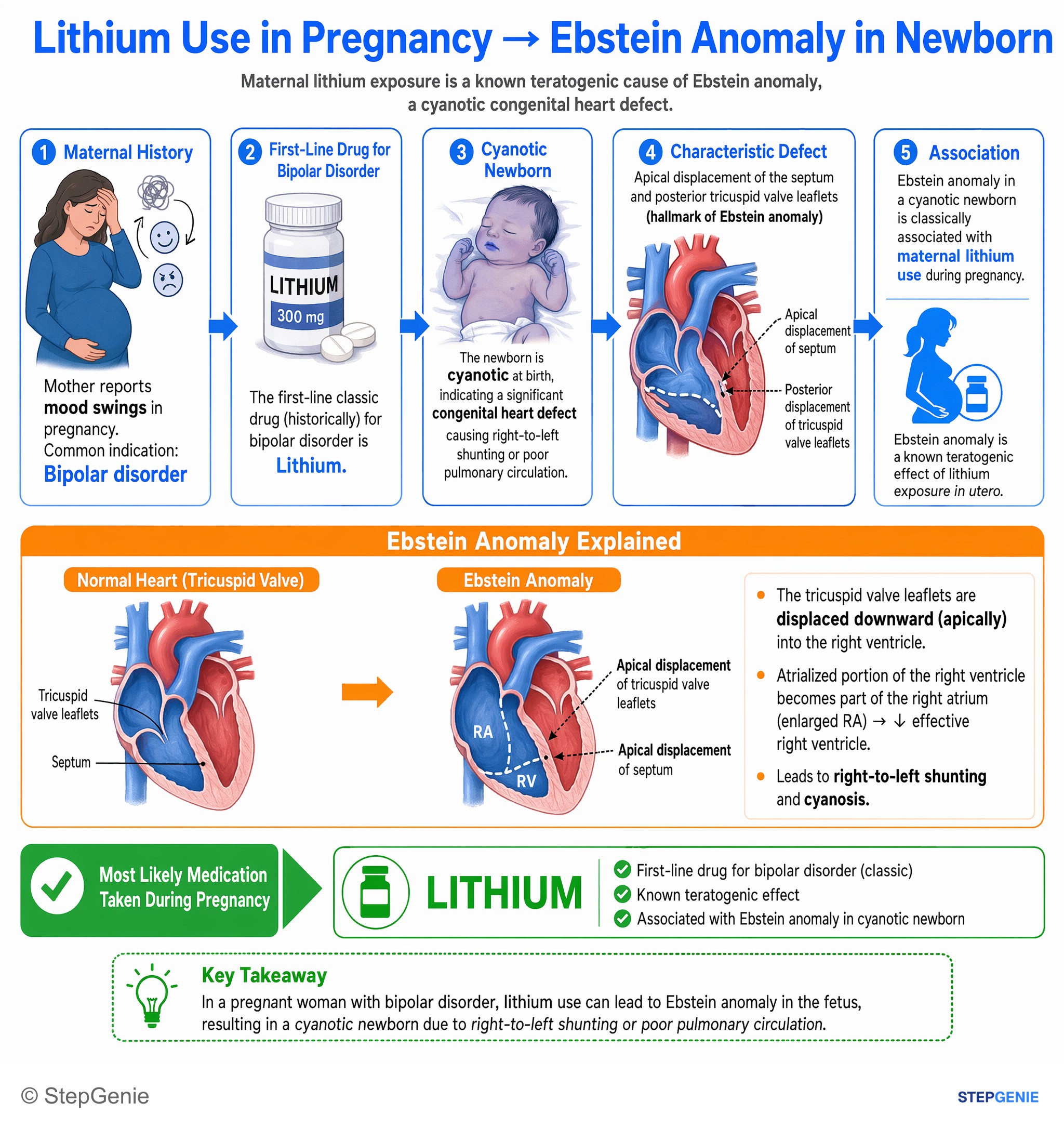 Congenital heart disease — StepGenie USMLE Step 1 explanation infographic