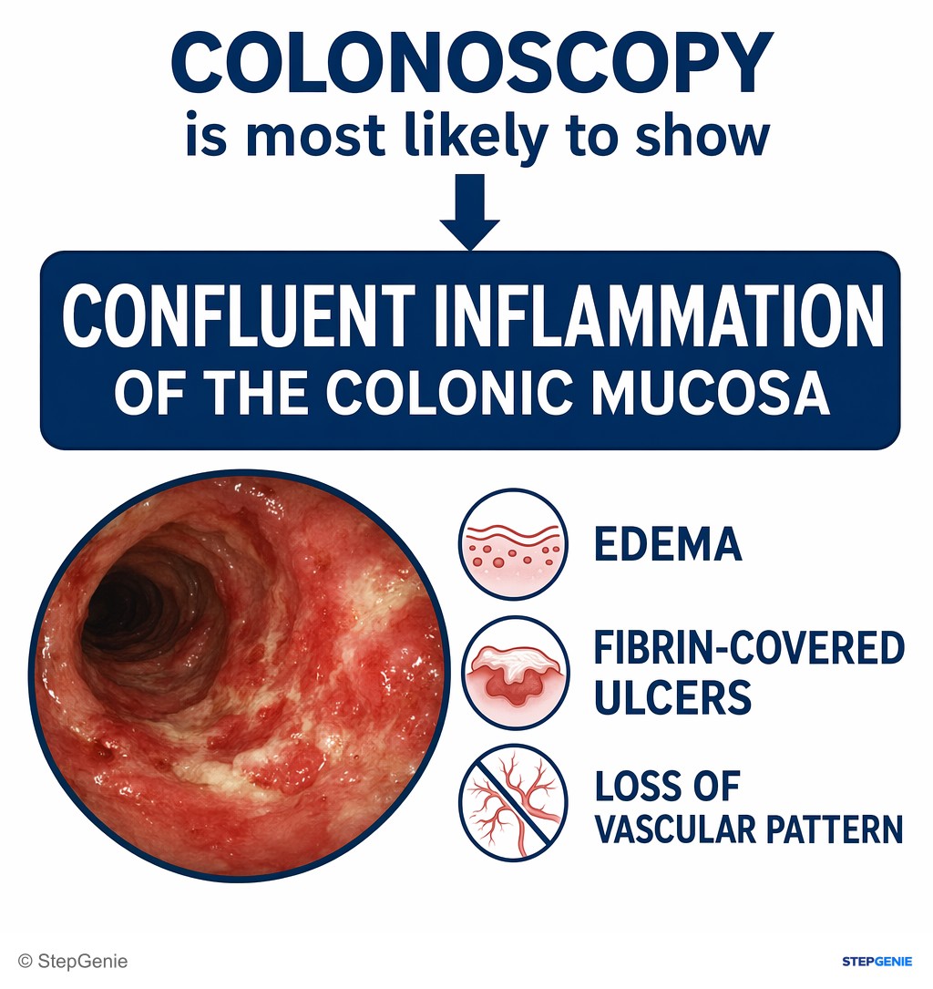 Reasoning step 6: Therefore, colonoscopy is most likely to show confluent inflammation of the colonic mucosa with edema, fibrin-covered ulcers, and loss of vascular…