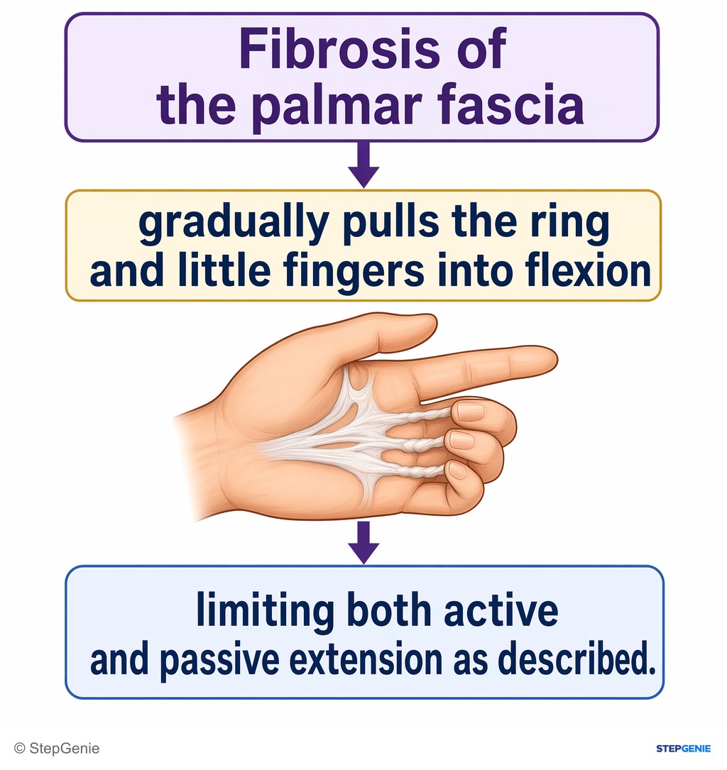 Reasoning step 4: Fibrosis of the palmar fascia gradually pulls the ring and little fingers into flexion, limiting both active and passive extension as described.