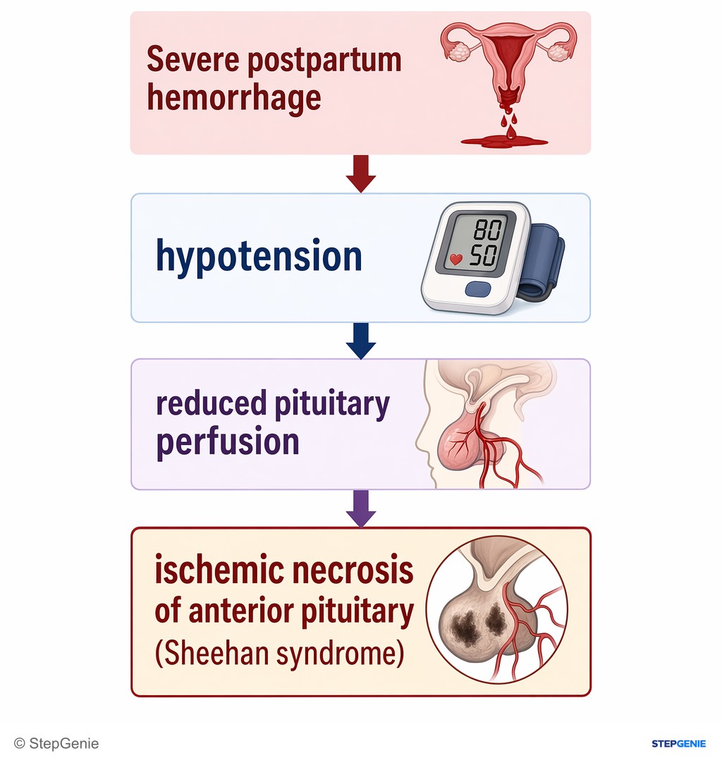 Reasoning step 2: Severe postpartum hemorrhage → hypotension → reduced pituitary perfusion → ischemic necrosis of anterior pituitary (Sheehan syndrome).