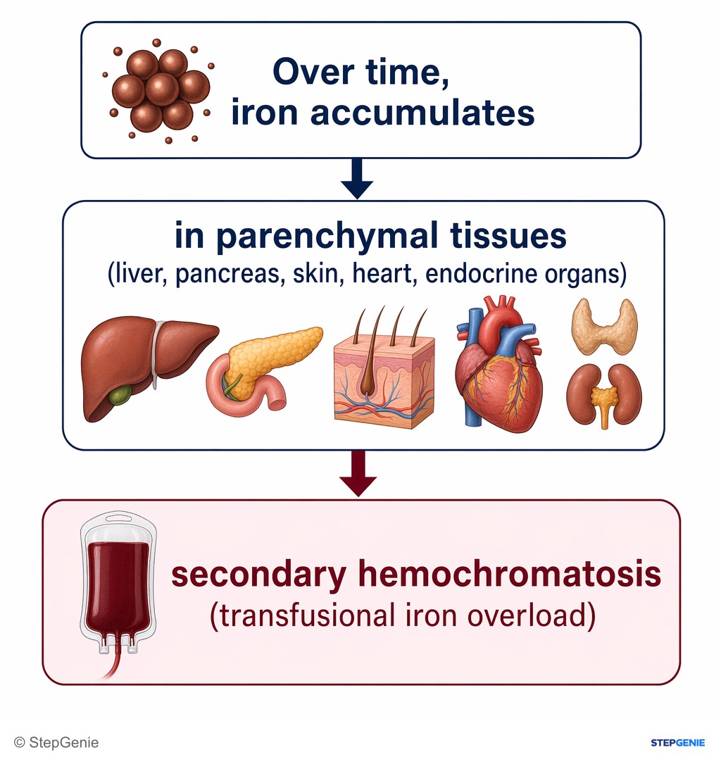 Reasoning step 3: Over time, iron accumulates in parenchymal tissues (liver, pancreas, skin, heart, endocrine organs) → secondary hemochromatosis (transfusional iron…
