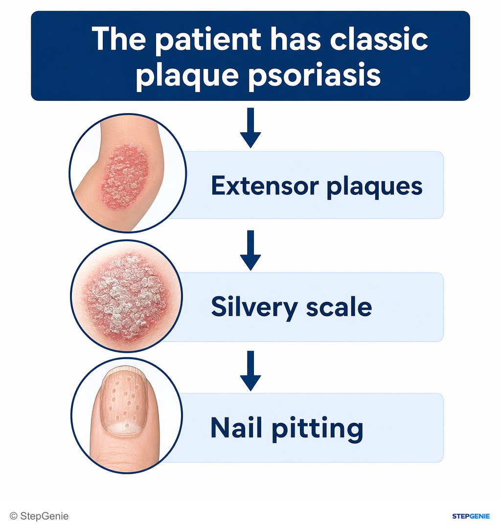 Reasoning step 1: The patient has classic plaque psoriasis (extensor plaques, silvery scale, nail pitting).