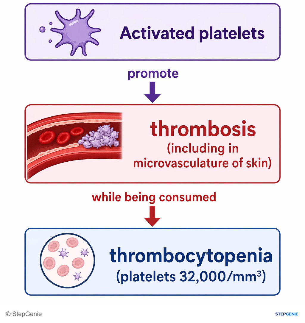 Reasoning step 4: Activated platelets promote thrombosis (including in microvasculature of skin) while being consumed, leading to thrombocytopenia (platelets…