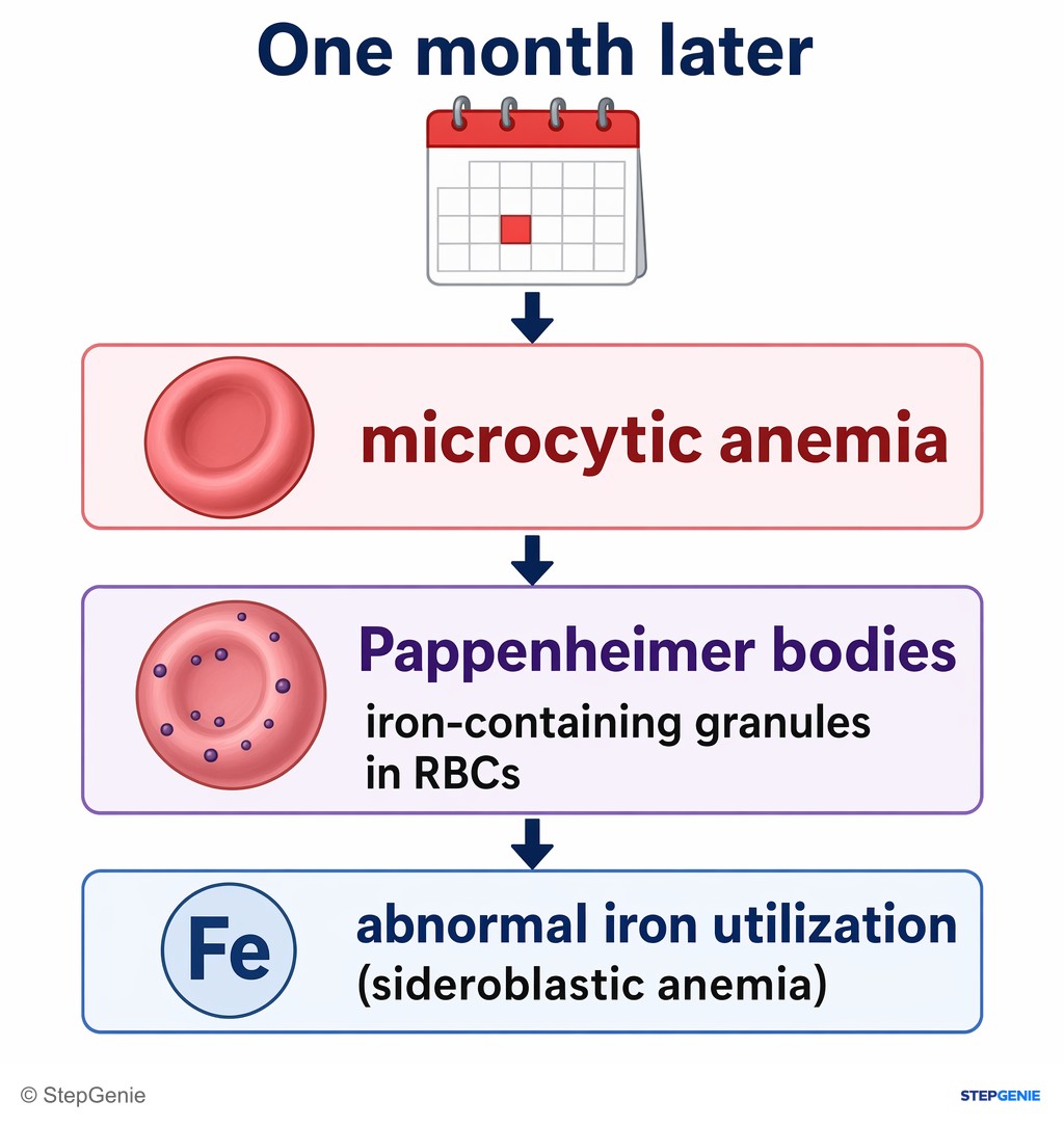 Reasoning step 2: One month later he has microcytic anemia with Pappenheimer bodies, which are iron-containing granules in RBCs seen with abnormal iron utilization…