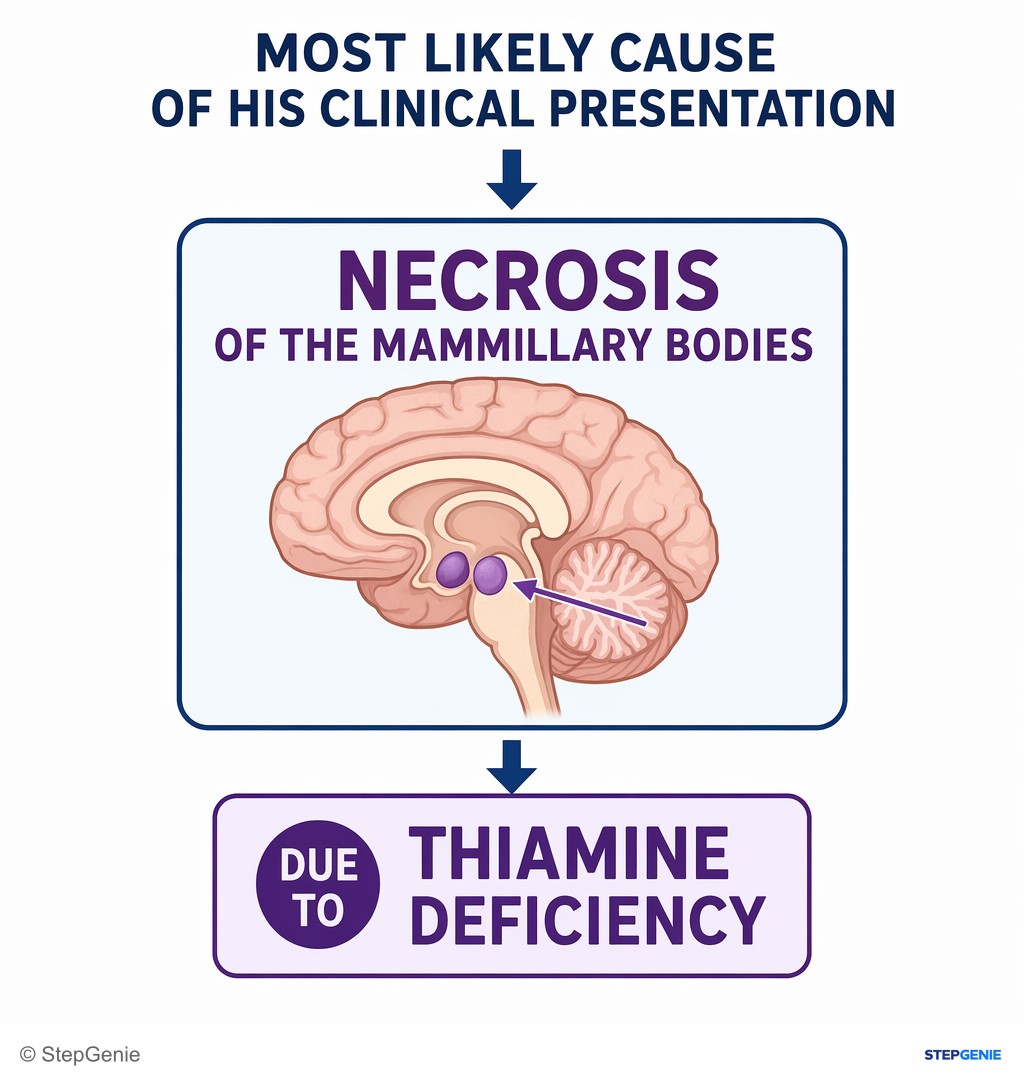 Reasoning step 5: Therefore, the most likely cause of his clinical presentation is necrosis of the mammillary bodies due to thiamine deficiency.