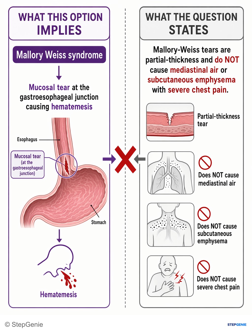 Why not Mallory Weiss syndrome: This option implies a mucosal tear at the gastroesophageal junction causing hematemesis, BUT Mallory-Weiss tears are partial-thickness and…